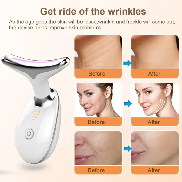 Facial Massager EMS Facial Microcurrent Anti-aging Facial Massager Red Light Therapy Skin Tightening Neck Face Lifting Massager - Image 6